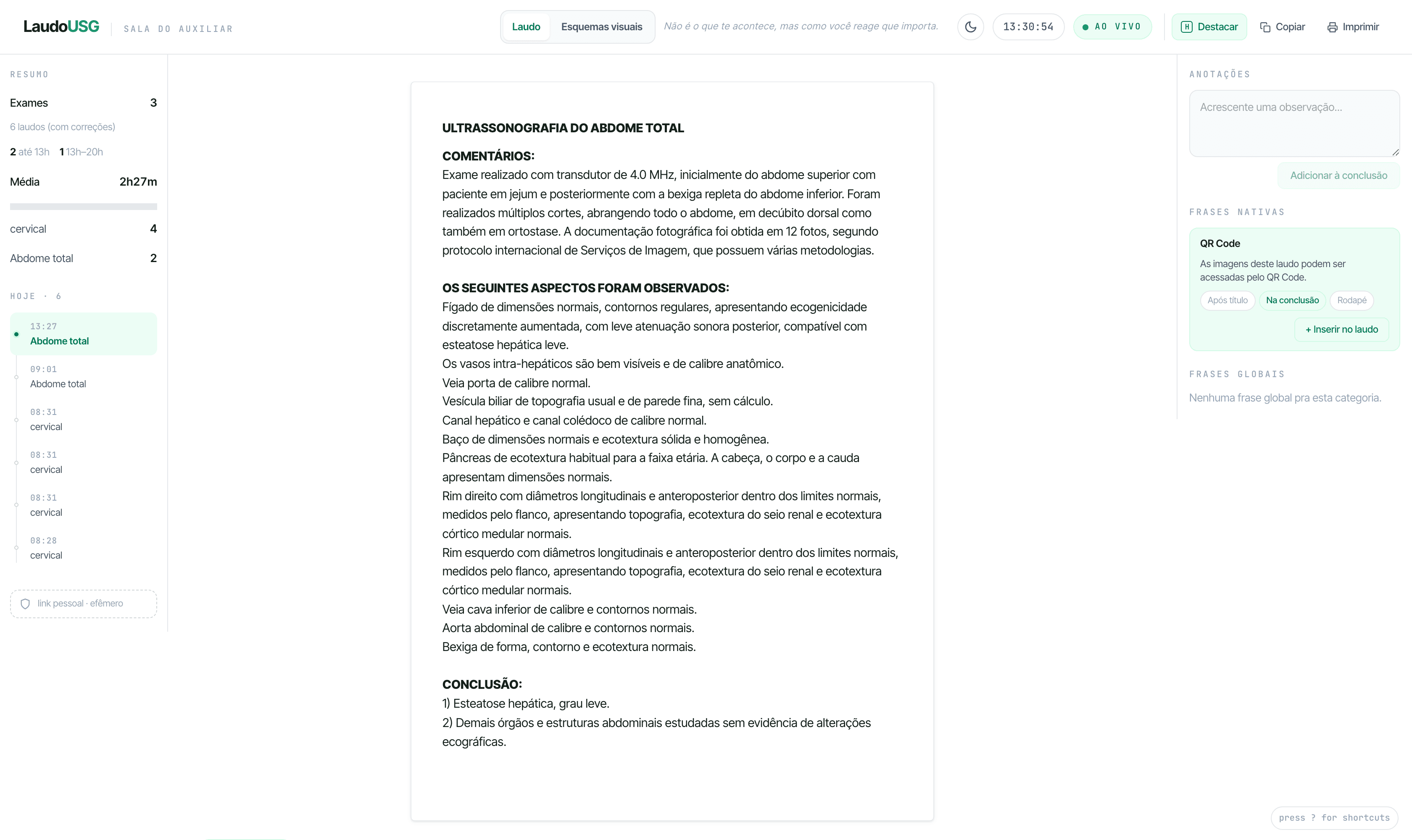 Sala do Auxiliar aberta: o laudo do exame aparecendo em tempo real, com a lista de exames do turno e o painel de anotações da equipe